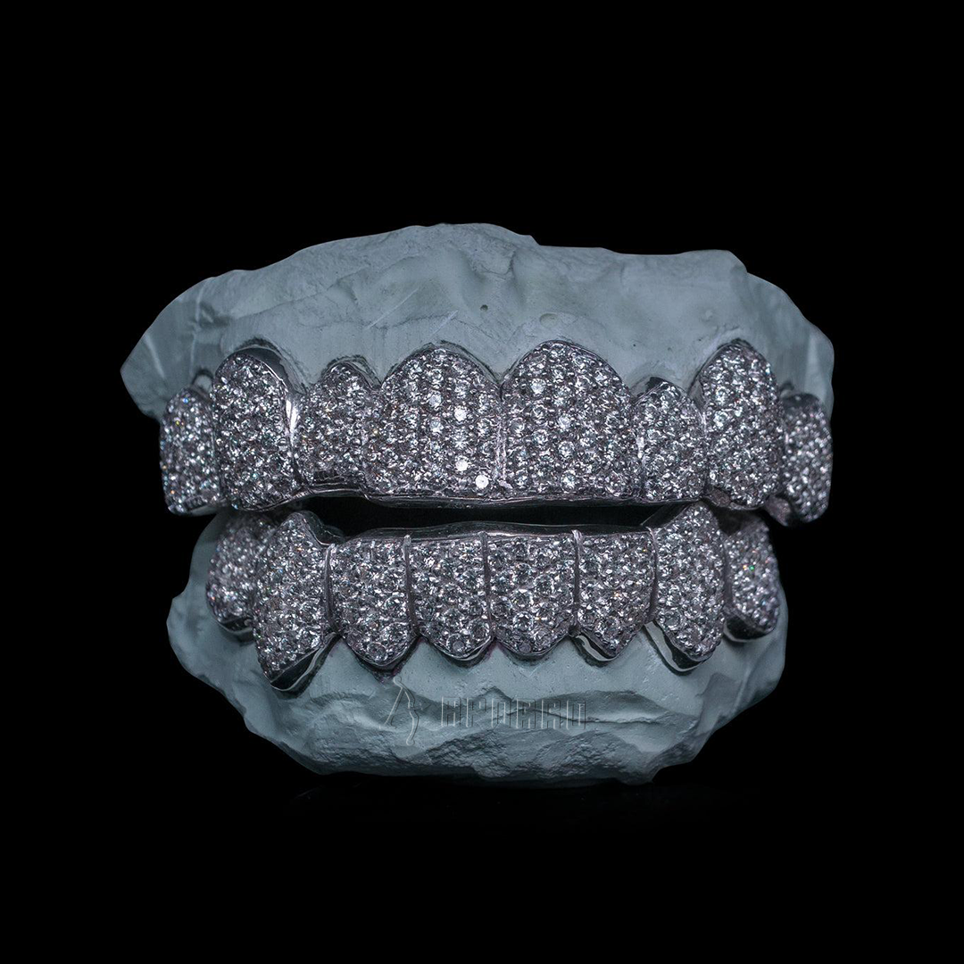 Custom Zig Zag Setting Iced VVS Moissanite Grillz