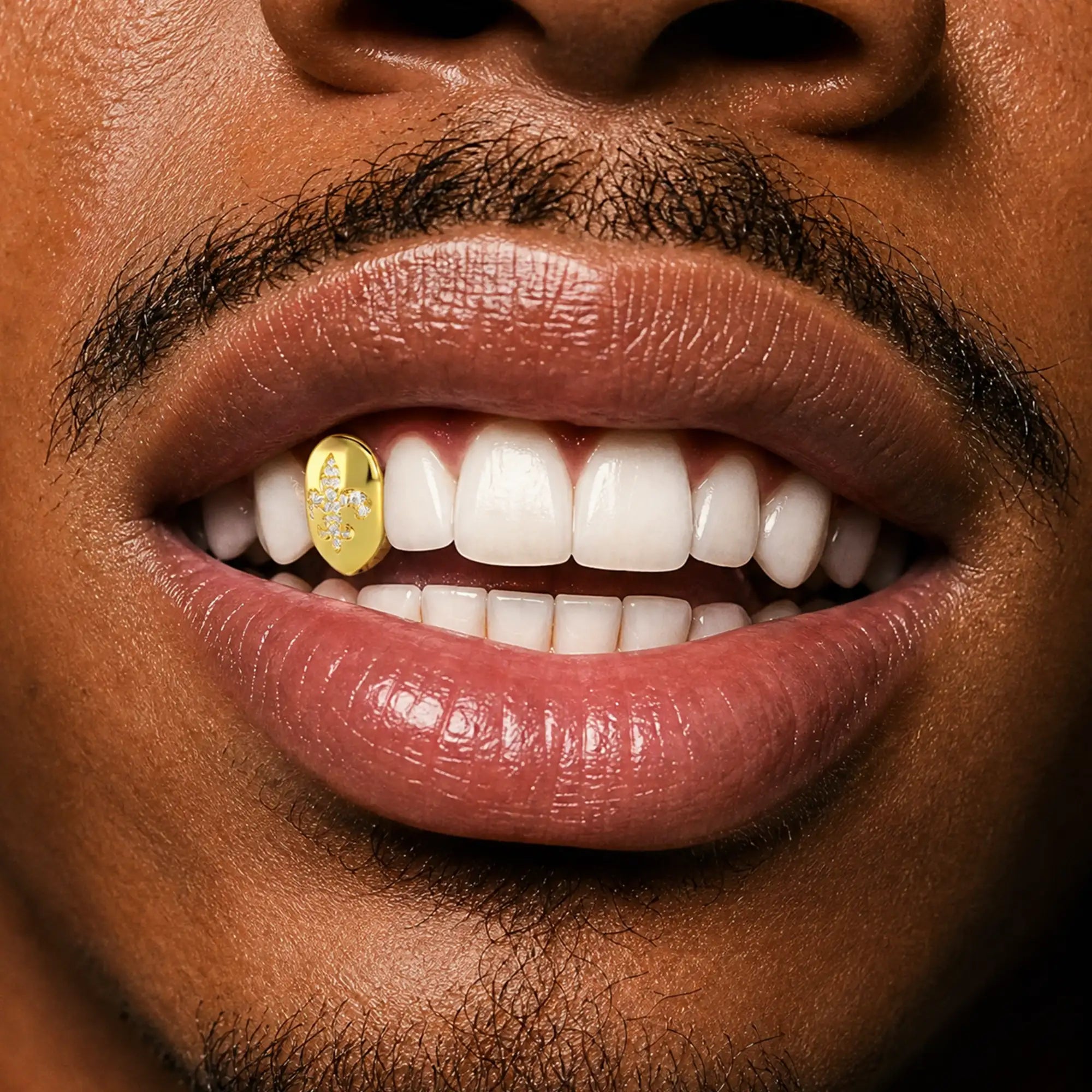 Custom Irises Inlay Grillz