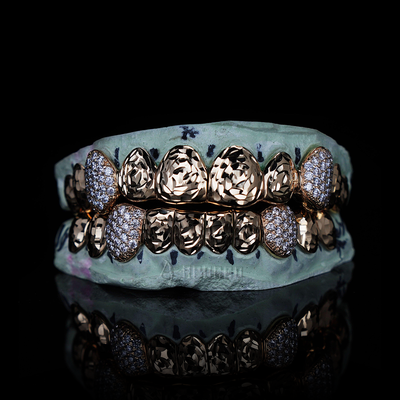 APORRO Premium Custom Grillz