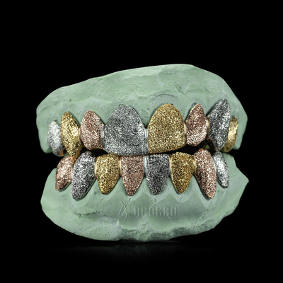 APORRO Premium Custom Iced-out Grillz