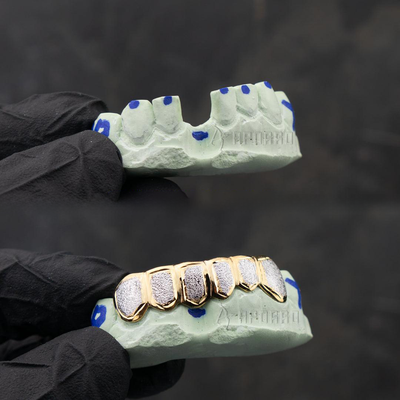 Custom Two Tone Diamond Dust Grillz