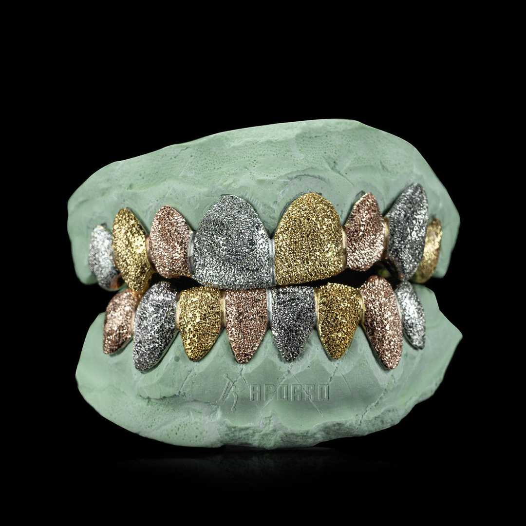 Custom Tri-Color Diamond Dust Grillz