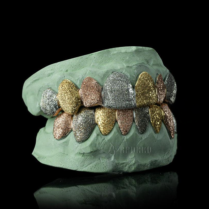 Custom Tri-Color Diamond Dust Grillz