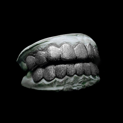 Custom Diamond Dust Grillz