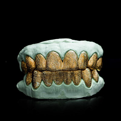 APORRO Premium Custom Iced-out Grillz