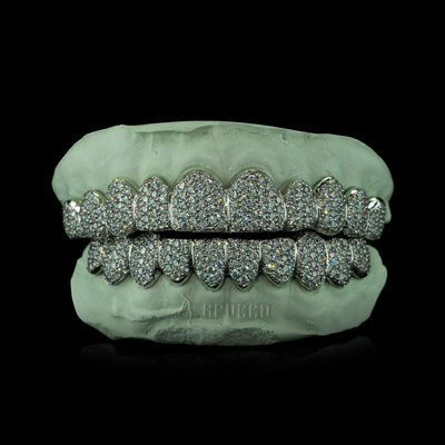 Custom Zig Zag Setting Iced VVS Moissanite Grillz