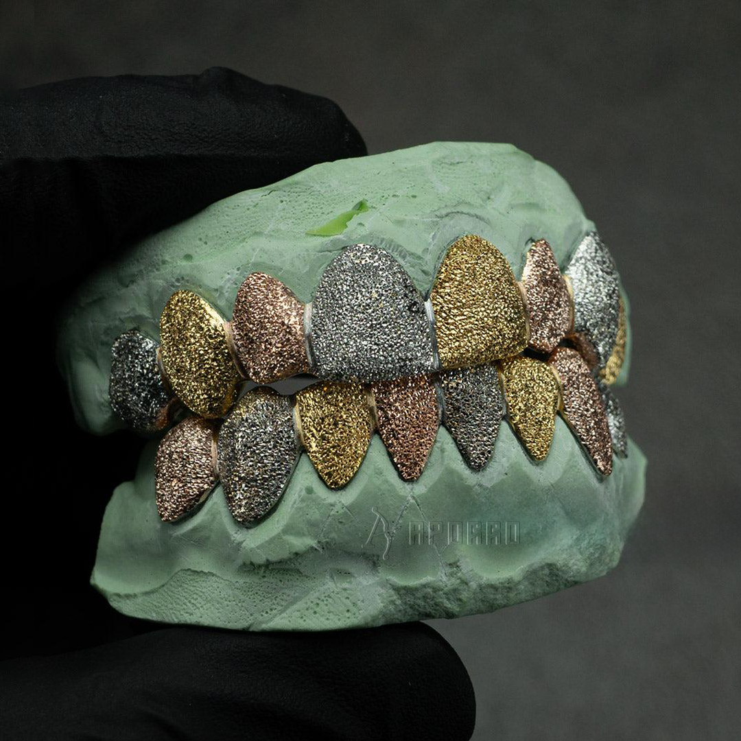 Custom Tri-Color Diamond Dust Grillz