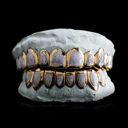 Custom Two Tone Diamond Dust Grillz