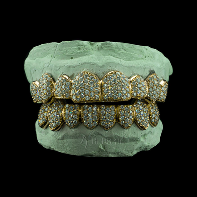 APORRO Premium Custom Iced-out Grillz