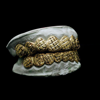 Custom Diamond Cut with Diamond Dust Grillz