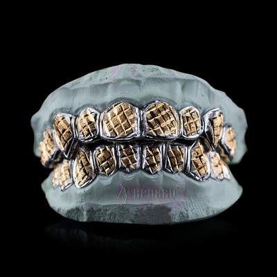 APORRO Premium Custom Grillz