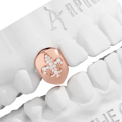 Custom Irises Inlay Grillz