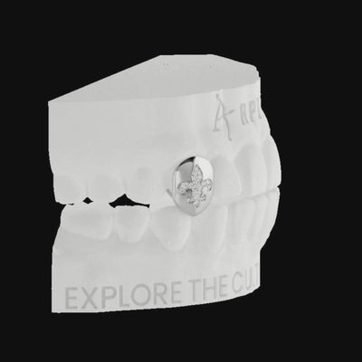Custom Irises Inlay Grillz